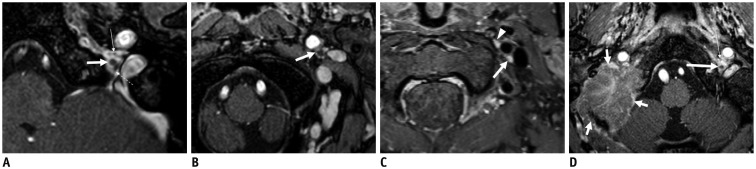 Fig. 15