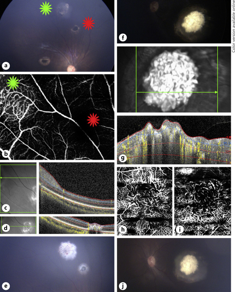 Fig. 4