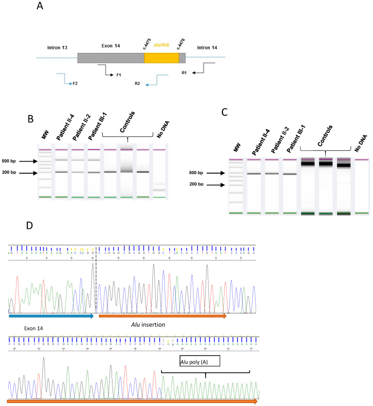 Identification and Characterization of New Alu Element Insertion in the ...