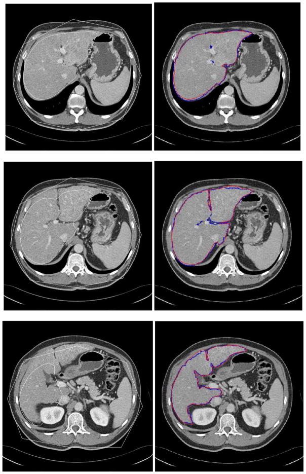 Fig. 13