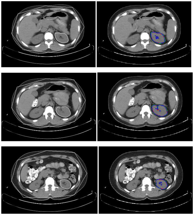 Fig. 10