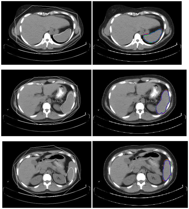 Fig. 11