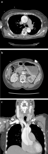 Fig. 6