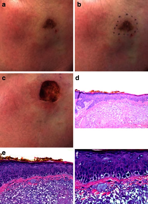 Fig. 3