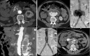 Fig. 11