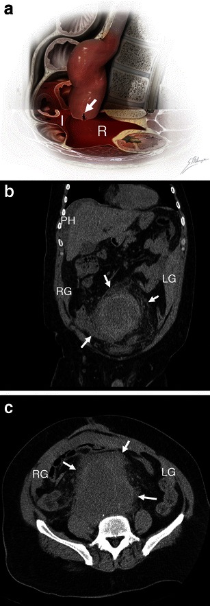 Fig. 11