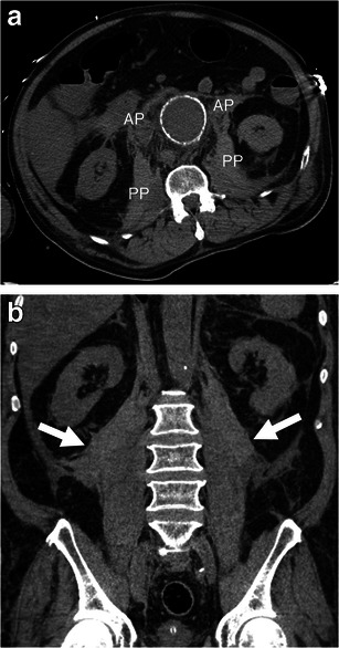 Fig. 10