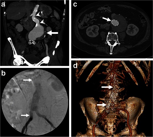 Fig. 13