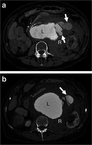 Fig. 9