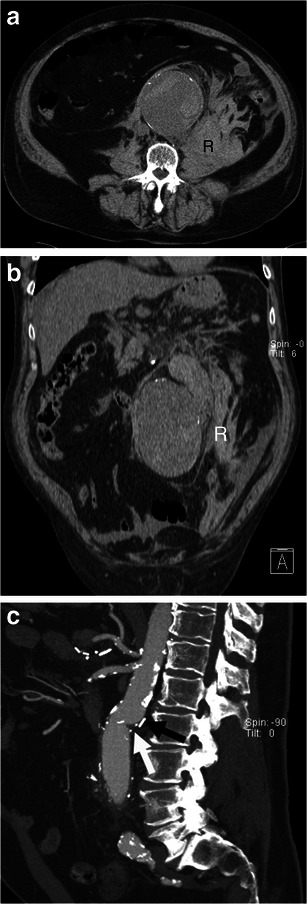 Fig. 12