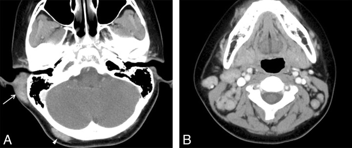 Fig 2.