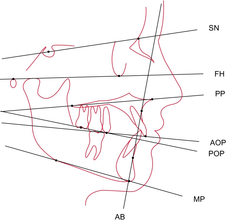 Fig. 1