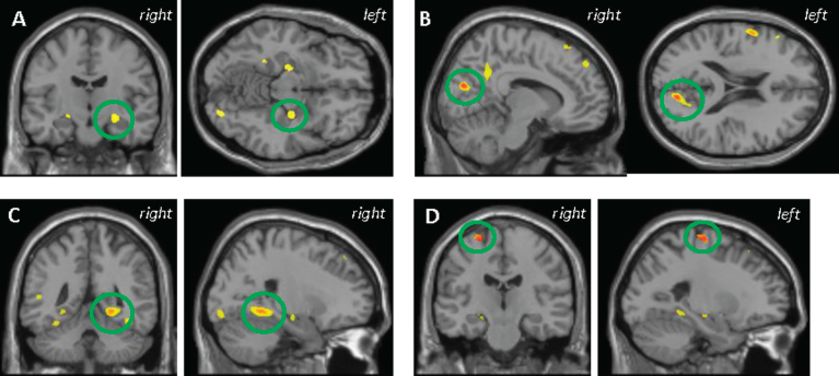 Fig.2