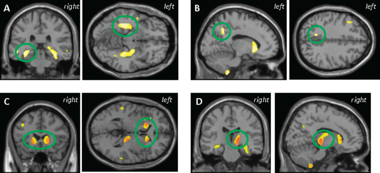 Fig.1