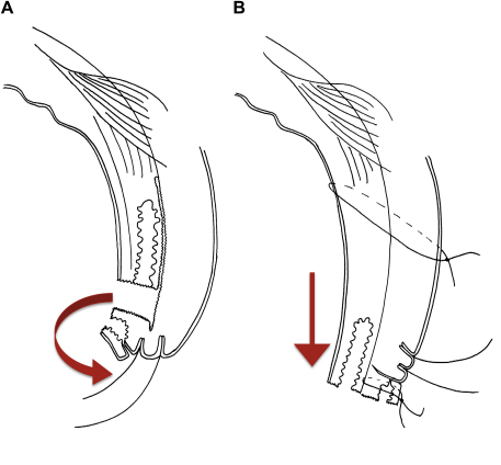 Fig. 5