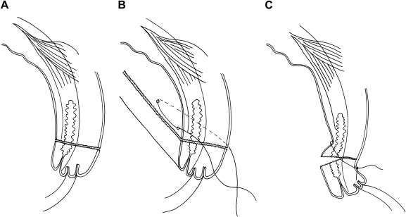 Fig. 3