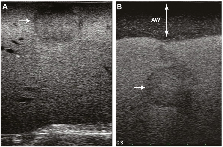 Fig 14