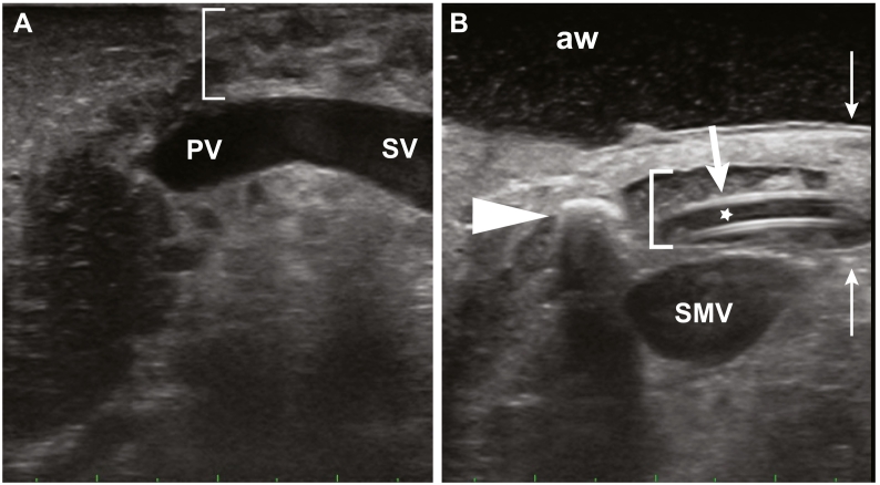Fig 30