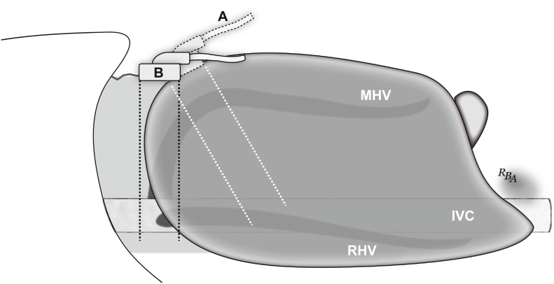 Fig 18