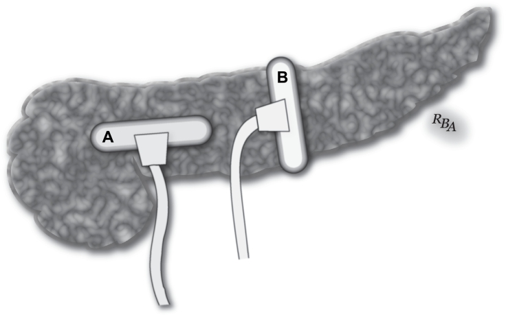 Fig 31