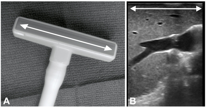 Fig 12