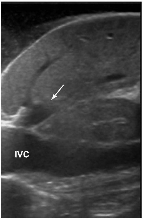 Fig 20