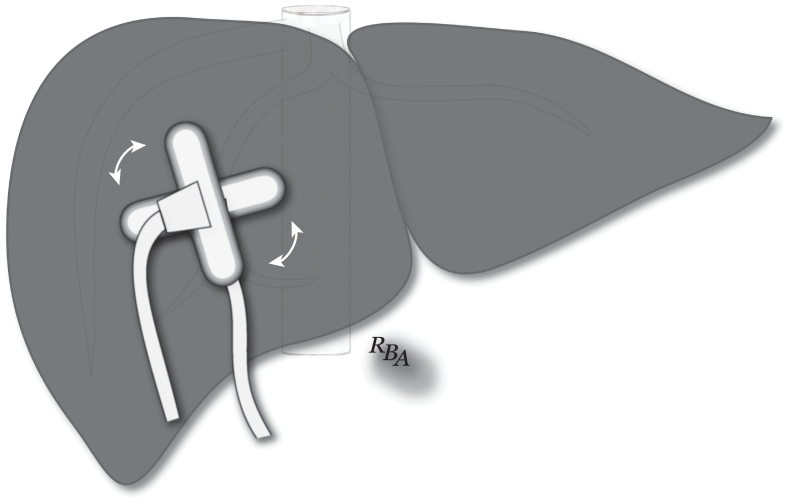 Fig 16