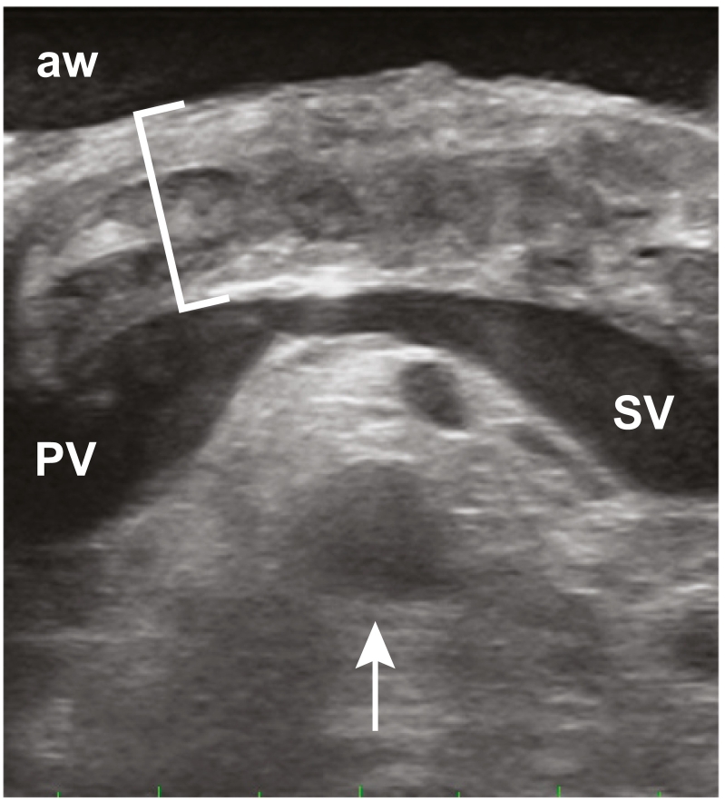 Fig 32