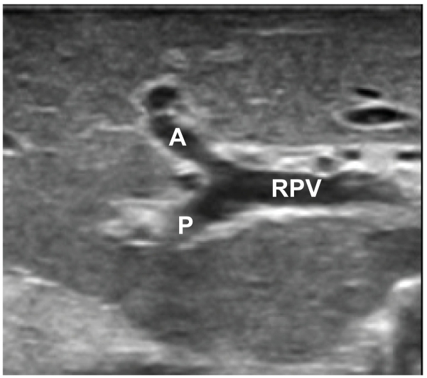 Fig 22