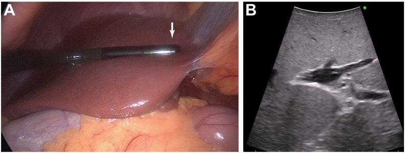 Fig 35