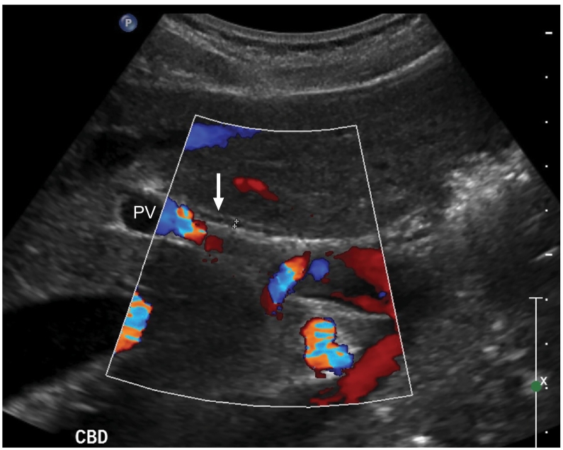Fig 10