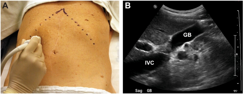 Fig 8