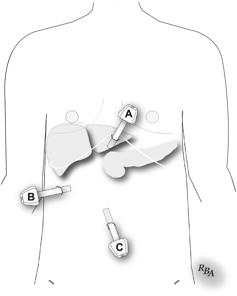 Fig 34