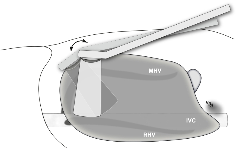 Fig 38