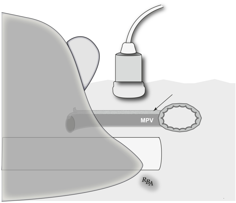 Fig 26