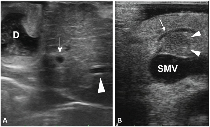 Fig 33