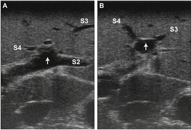 Fig 23