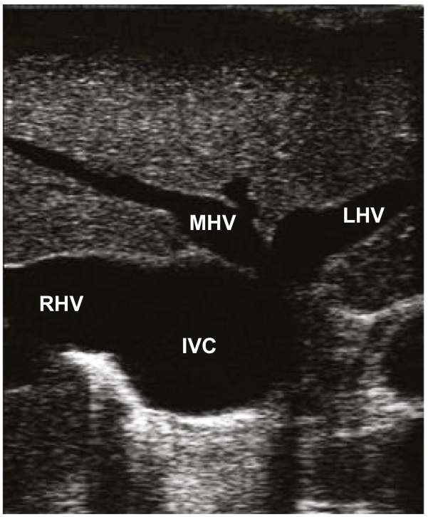 Fig 19