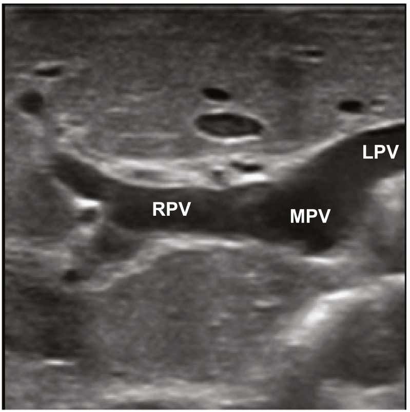 Fig 21