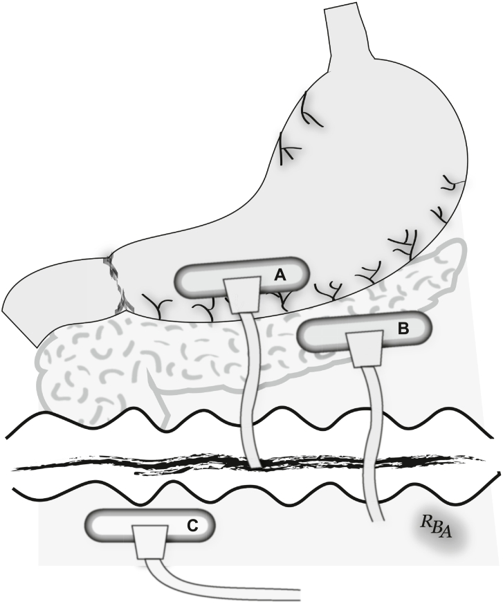 Fig 29