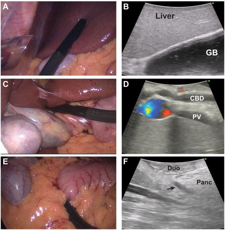 Fig 43