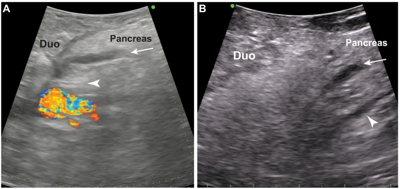 Fig 42