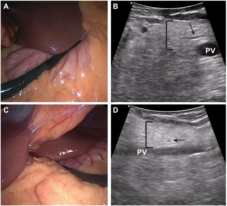Fig 44