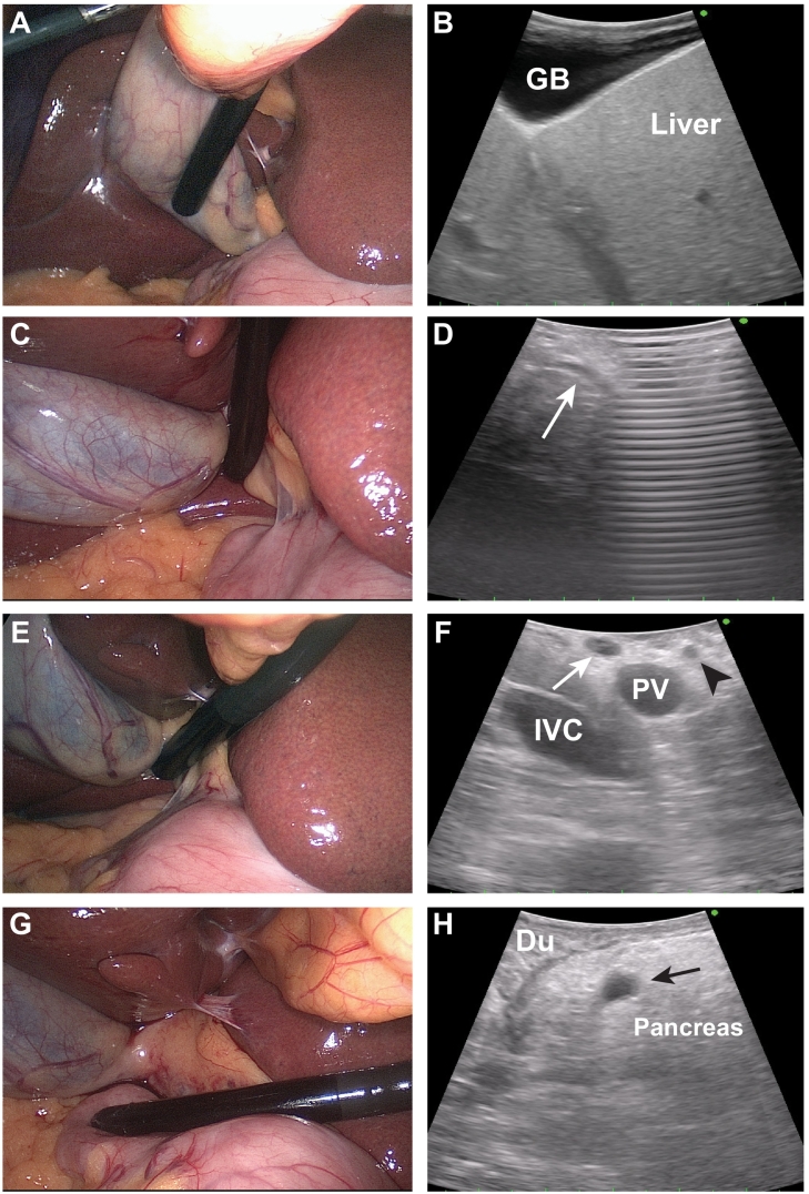Fig 41