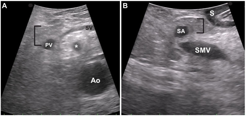 Fig 45