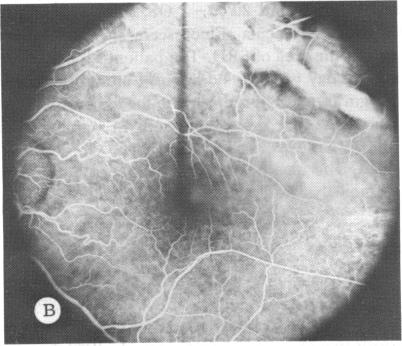 FIGURE 5 B