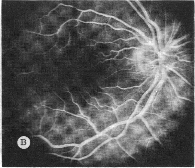 FIGURE 4 B