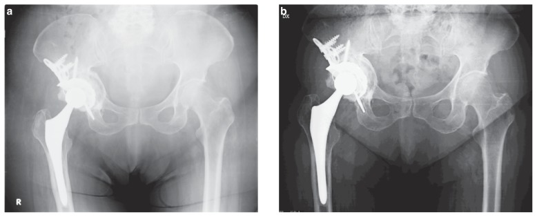 Figure 3 a, b