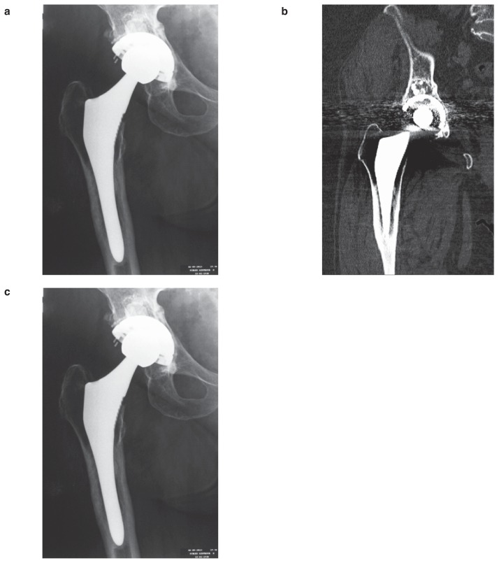 Figure 2 a–c