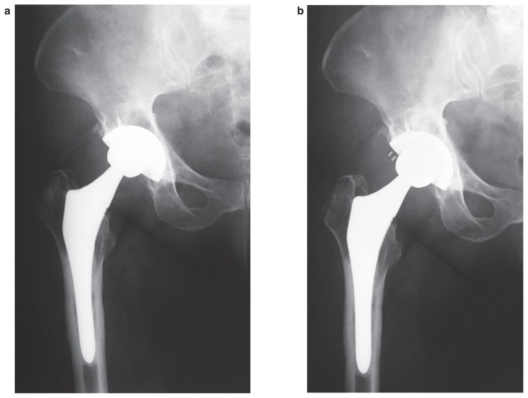 Figure 1 a, b